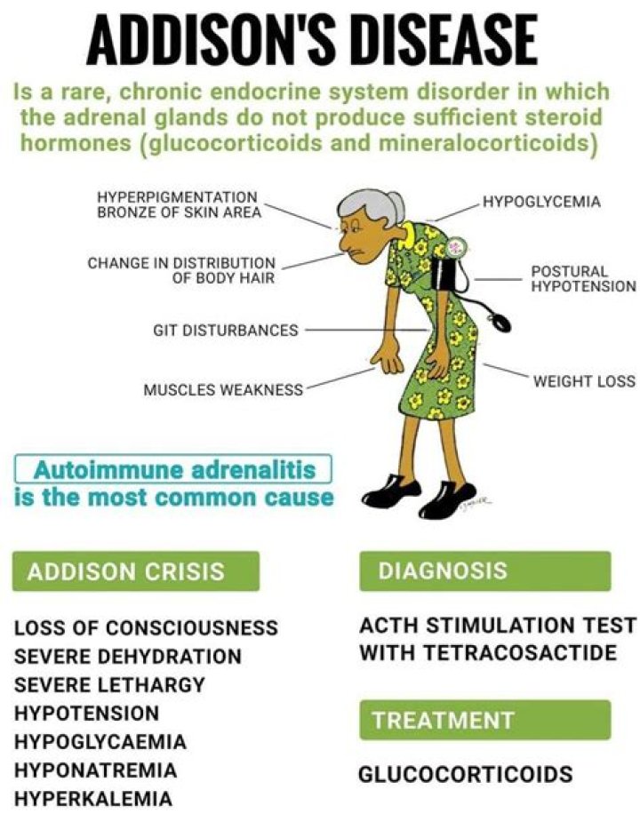 What is the life expectancy of a person with Addison’s disease?