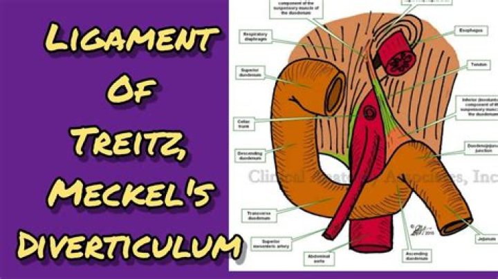 What is the ligament of Treitz?