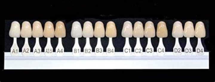 What shade is the most common tooth color?