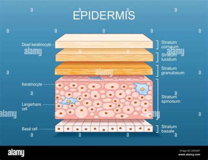 What type of tissue makes up epidermis?