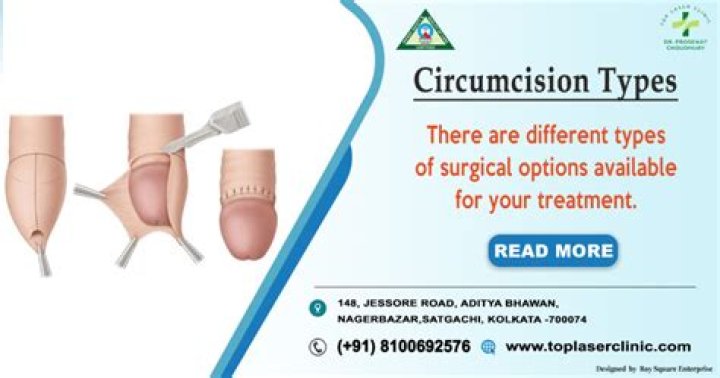 When should circumcision ring fall off?