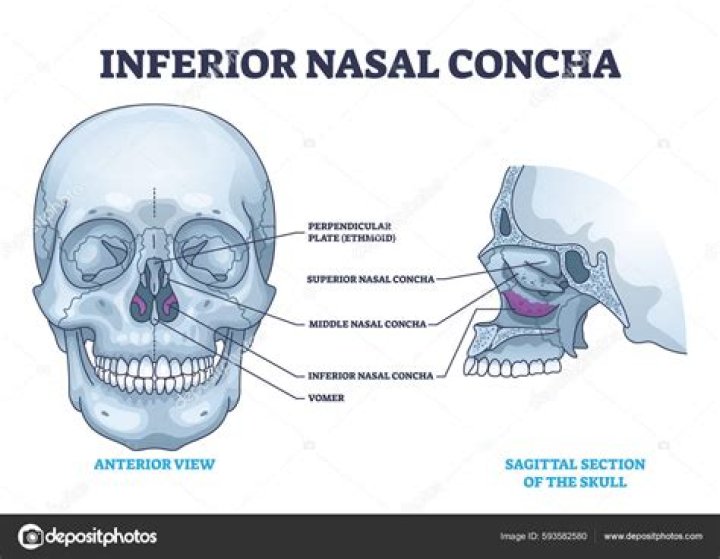 Which nasal concha is a facial bone?