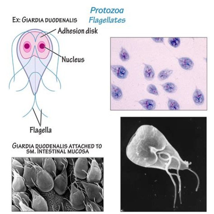Which of the following illnesses is caused by protozoa?